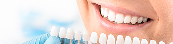 blanchiment dents villefranche