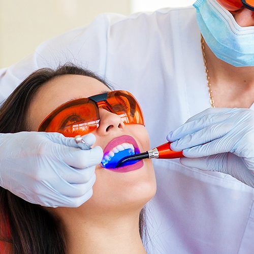 detartrage dents villefranche